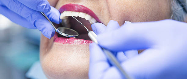 Best Emergency Dental Care for Broken or Chipped Teeth in Oxford, MS